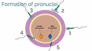 What are the options to terminate a 4 week pregnancy  Dr Premlata Subhash [upl. by Kucik]