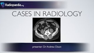 Cases in Radiology Episode 5 trauma CT abdomen [upl. by Hawthorn]