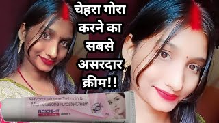 elosone ht cream review In Hindi 2024 [upl. by Merrel]