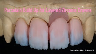 Porcelain Build Up for Layered Zirconia Crowns [upl. by Harbert]