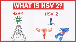 What is HSV 2 [upl. by Amble117]