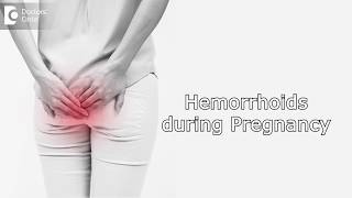 How to manage Hemorrhoids during Pregnancy  Dr Rashmi Chaudhary [upl. by Suiram]