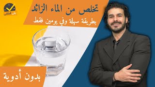 التخلص من الماء الزائد بالجسم في يومين بدون ادويةاسبابه وعلاجه الفعال والسريع [upl. by Asiulairam]