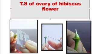 Transverse section  TS  of ovary of hibiscus flower [upl. by Natalina]