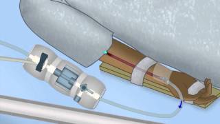 ThinWalled PRESSURE VESSELS in 8 MINUTES  Mechanics of Materials [upl. by Daryn]