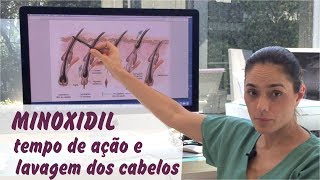 MINOXIDIL  tempo de ação no couro cabeludo e lavagem dos cabelos [upl. by Kirbee]