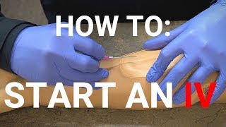 How To Start An IV [upl. by Hilliard216]