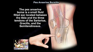 Pes Anserine Bursitis  Everything You Need To Know  Dr Nabil Ebraheim [upl. by Esertap]