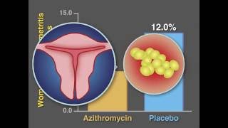 Caesarean Section In 5 Minutes  Maitri  Dr Anjali Kumar [upl. by Marcos]