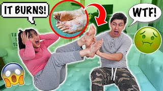 EXTREMELY DISGUSTING PEELING FEET PRANK ON BOYFRIEND [upl. by Ayo]